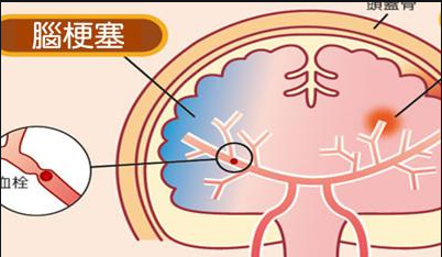 福州脑部外伤后会引起什么?脑部外伤可导致阳痿?